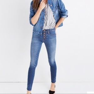 Madewell Highrose Skinny Button Fly Jeans